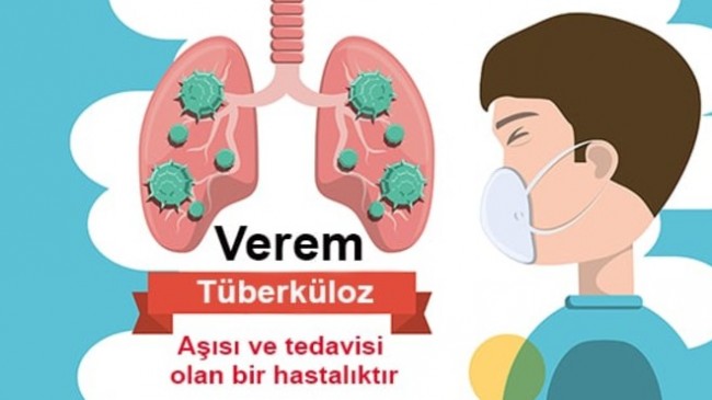 Her 22 saniyede 1 kişi veremden hayatını kaybediyor!