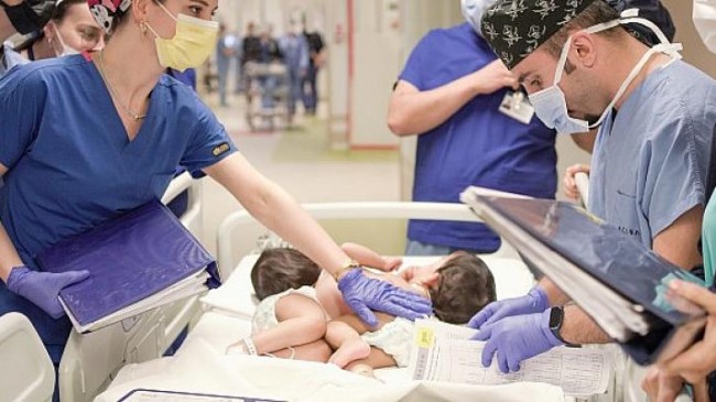 Cezayirli Yapışık İkizler Türkiye’de 9 Saat Süren Bir Operasyonla Kendi Bedenlerine Kavuştular